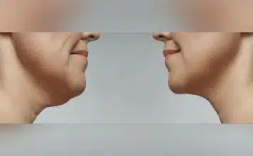 Comment affiner le visage par la chirurgie ?